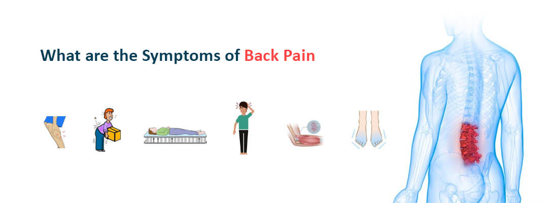 What are the Symptoms of Back Pain